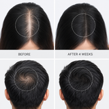 Ayurcetra Hair Growth Serum 30ml | Redensyl, Anagain & Baicapil Formula